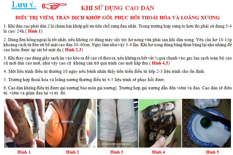 cac-benh-xuong-khop-thuong-gap (2)